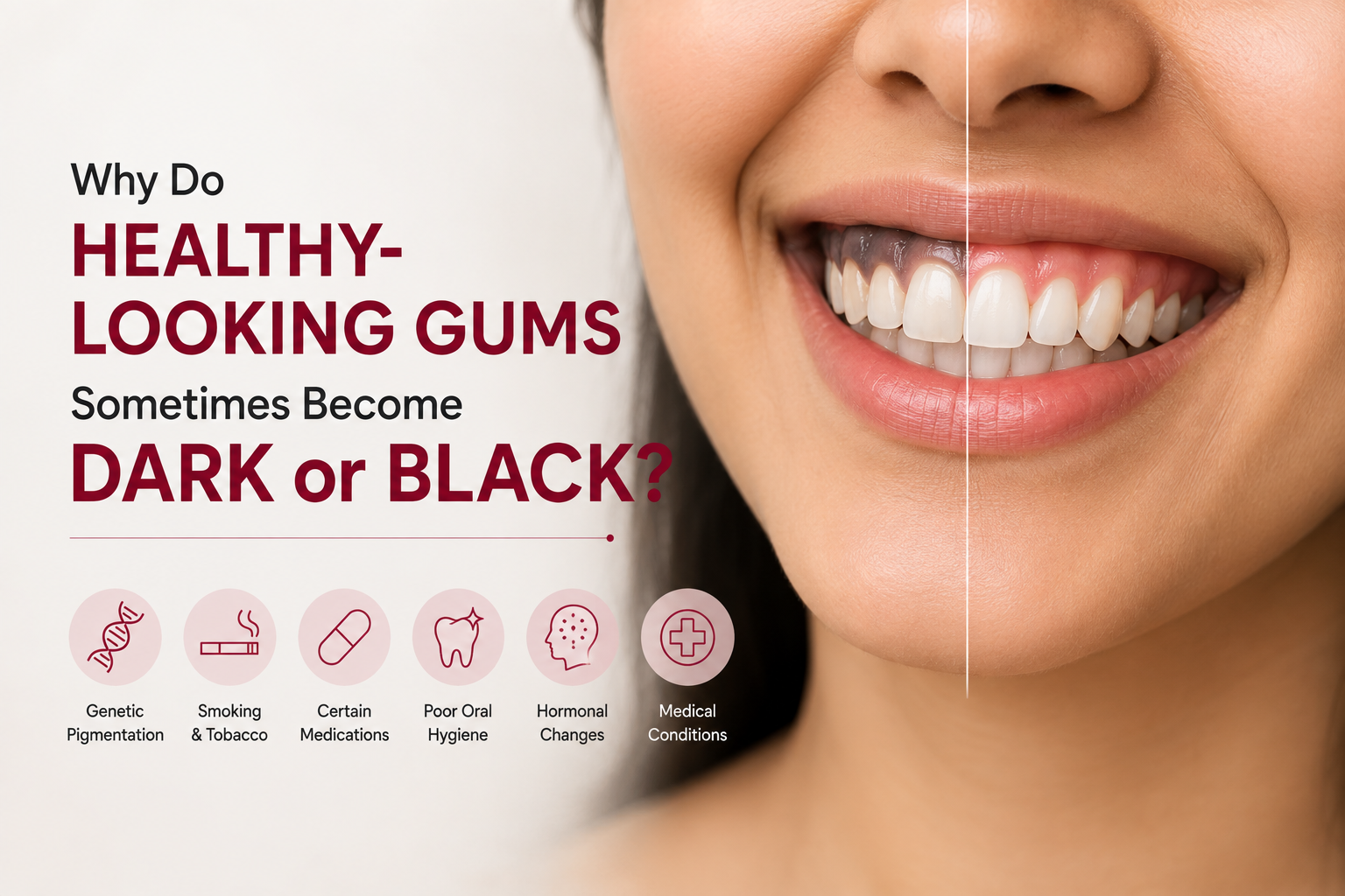 Why Do Healthy-Looking Gums Sometimes Become Dark or Black?