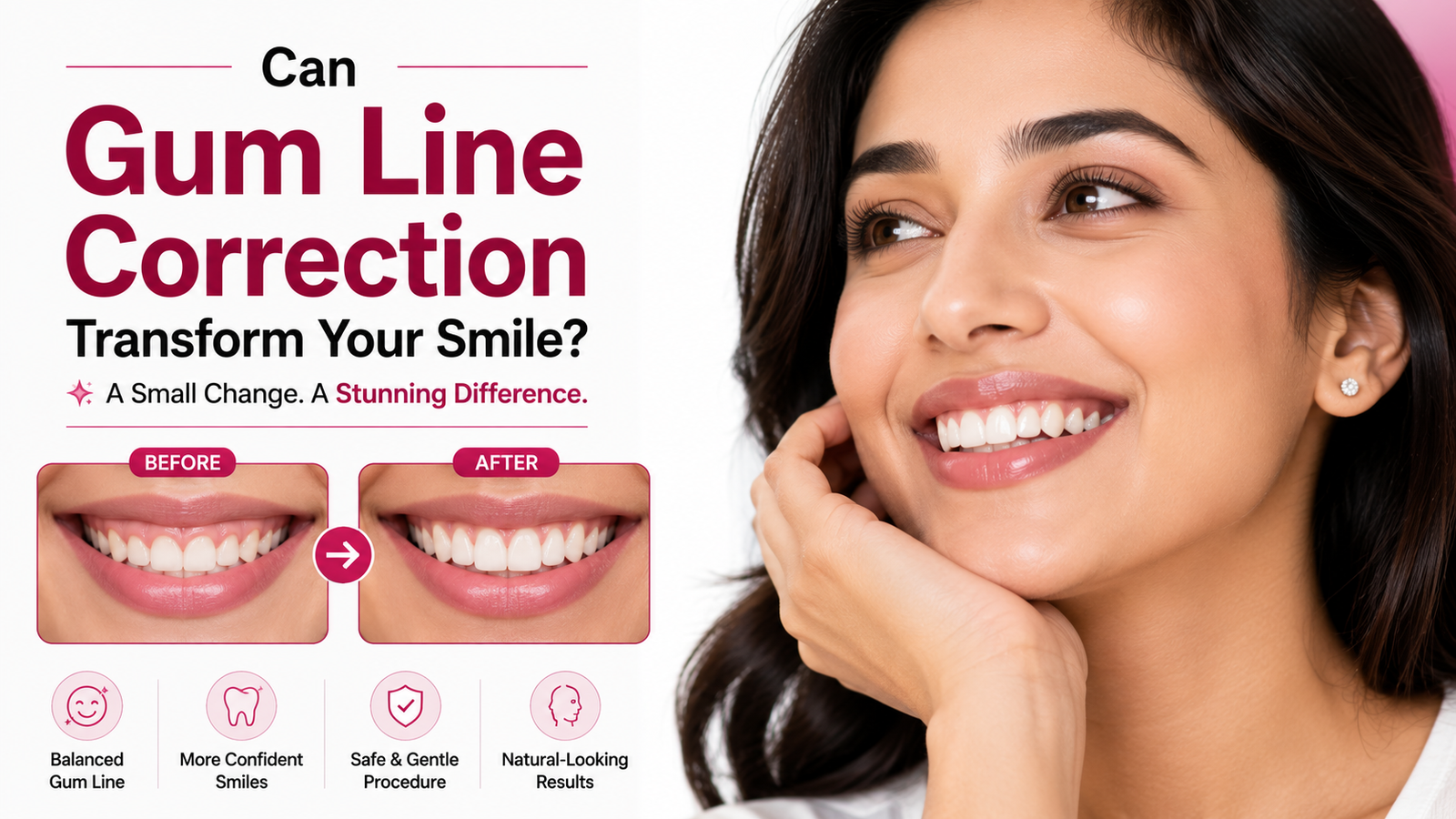 Can Gum Line Correction Transform Your Smile?